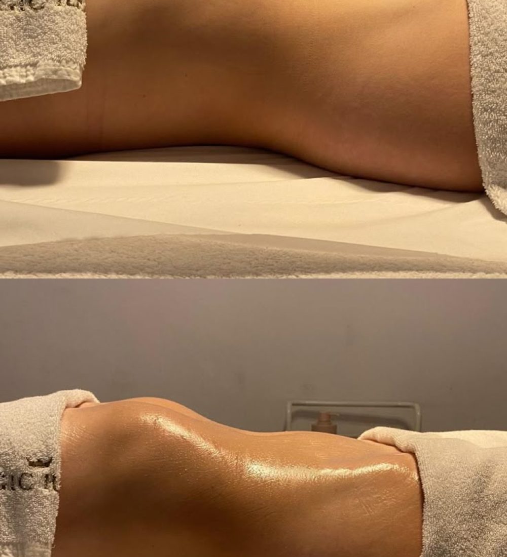 6. Quemadores de Grasa